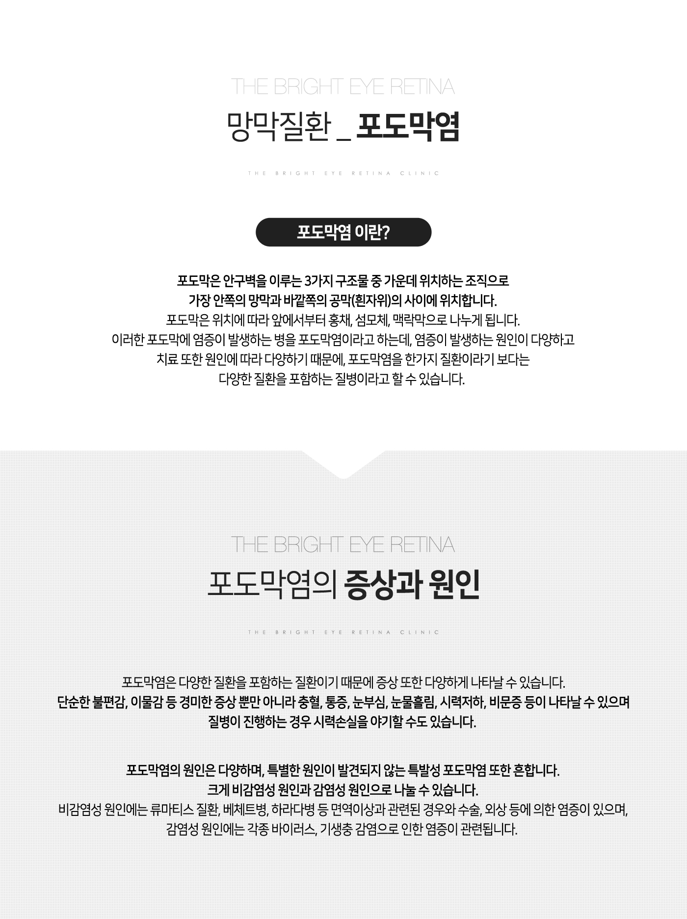 포도막염